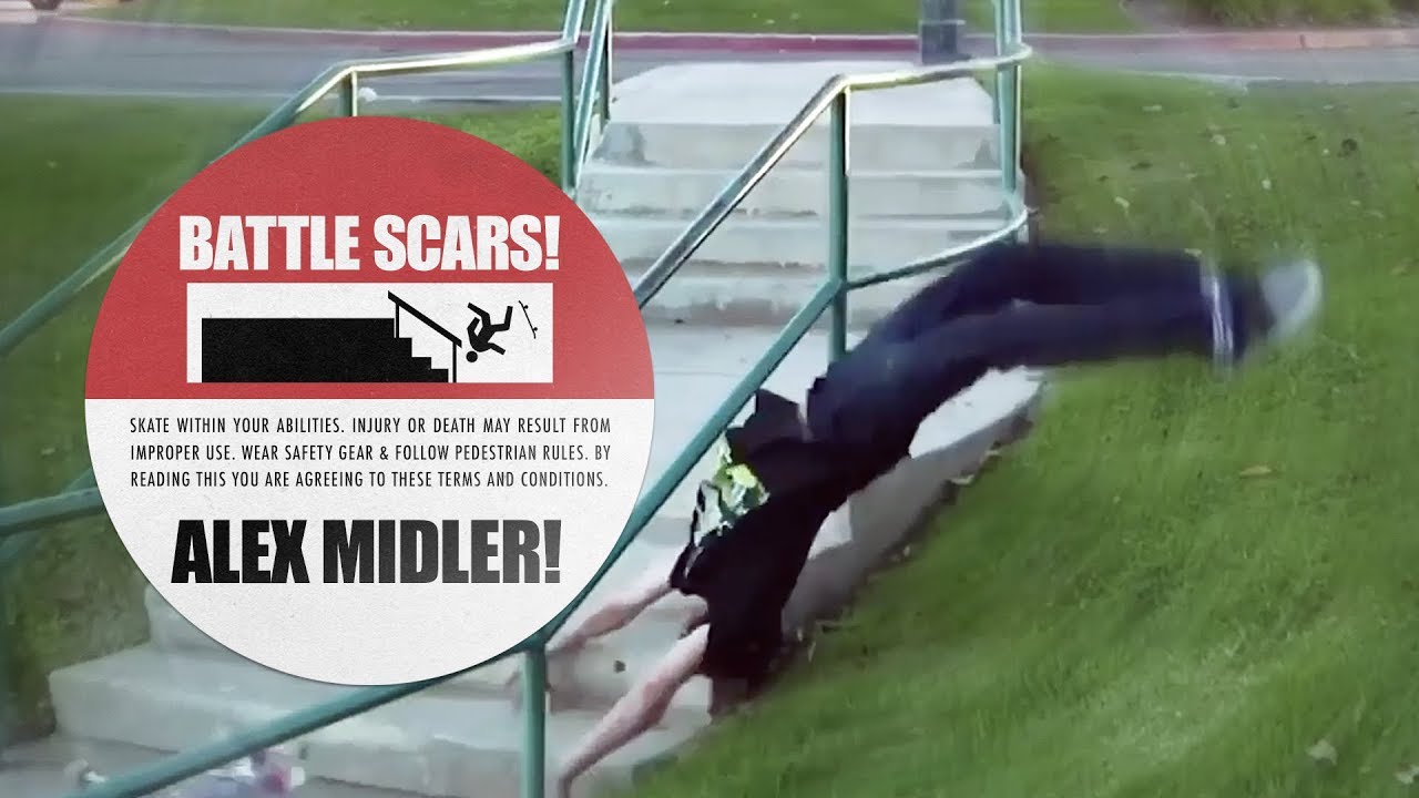 Alex Midler's Battle Scars