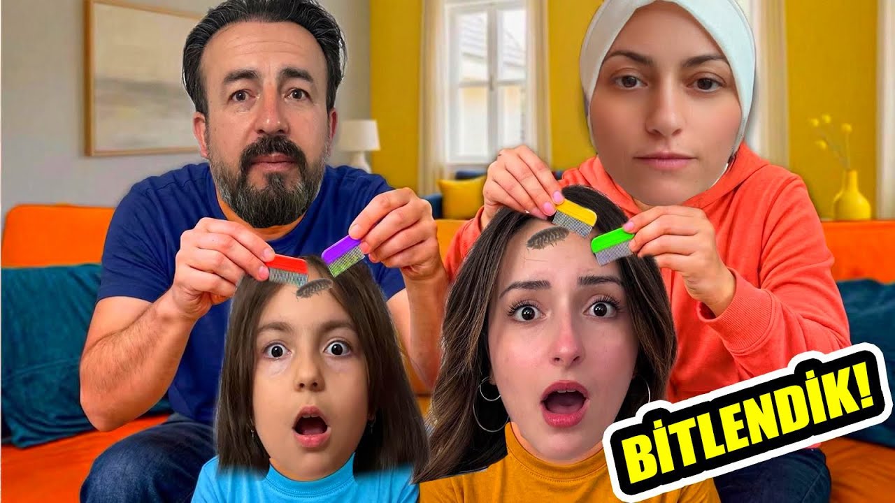 ZEYNEP VE HİRANUR BİTLENDİK !! 24 SAATTE NASIL KURTULDUK? (ŞOK OLDUK)