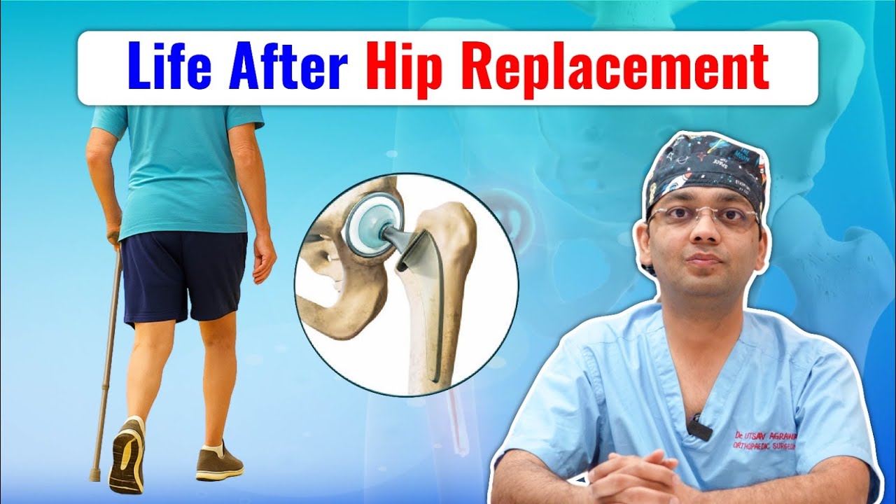 Hip Replacement Surgery के बाद क्या Expect करे | Dr. Utsav Agrawal, Knee & Hip Surgeon