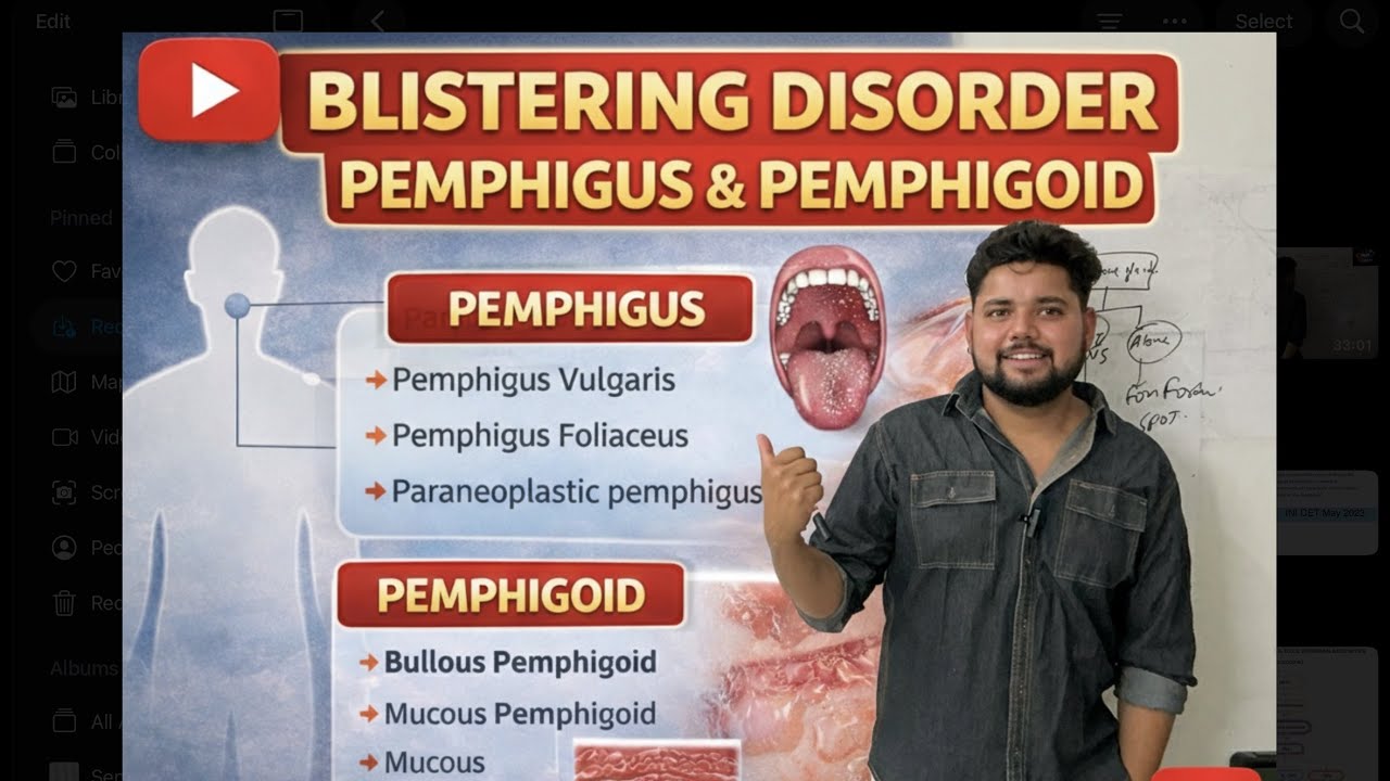 Blistering disorder@ Pemphigus # pemphigoid# SJS / INI cet