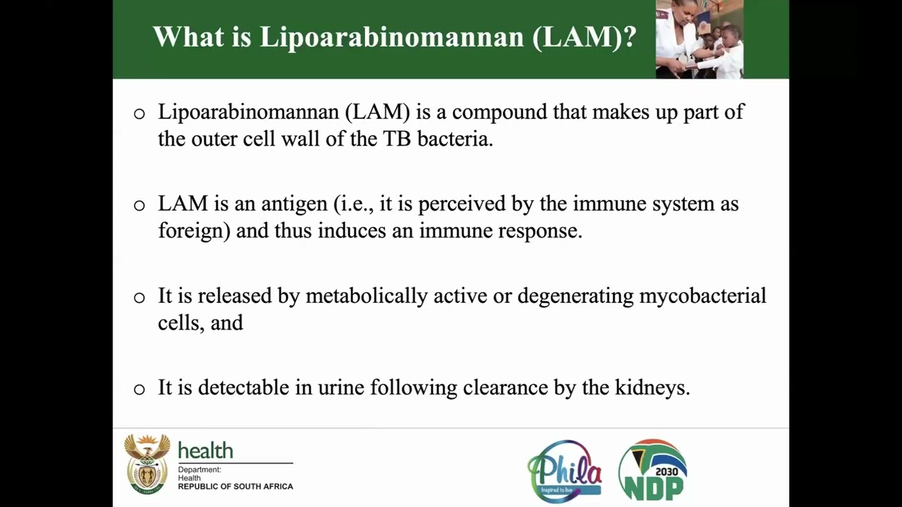 Expert Discussion on Urine LAM Test in HIV-Associated TB - Clinical Webinar