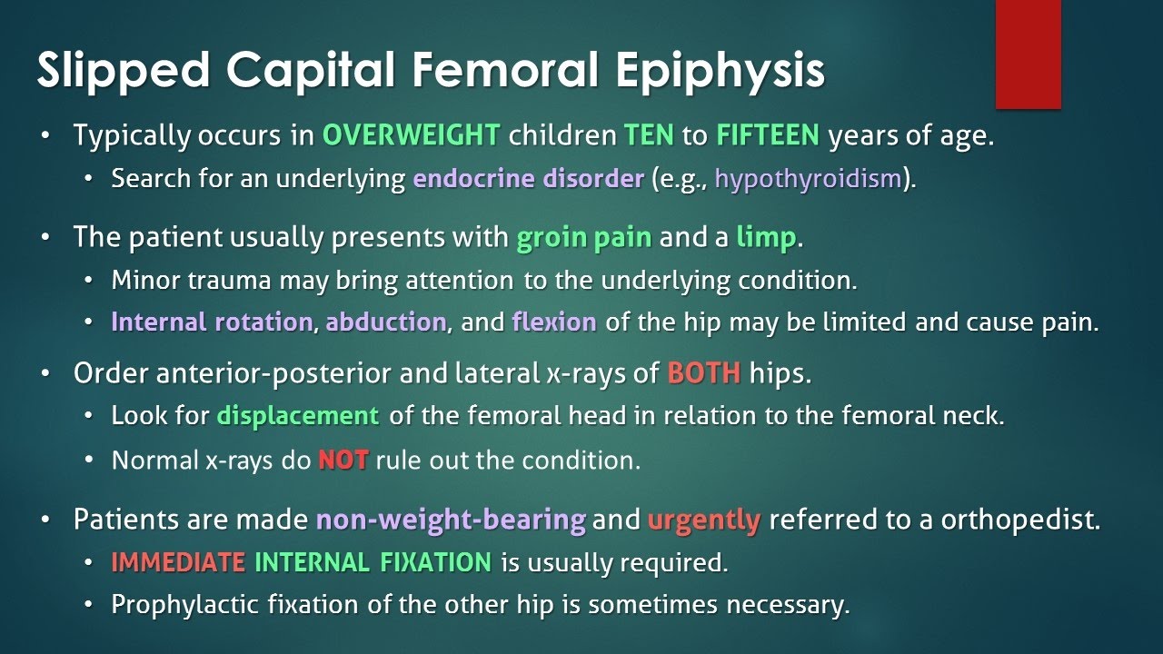 Slipped Capital Femoral Epiphysis