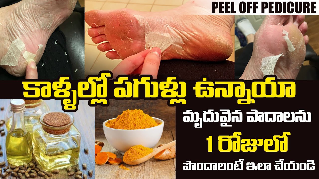 Foot Facial Removes Calluses And Dead Skin Home Made Therapy to Peel Pedicure | IRA Media