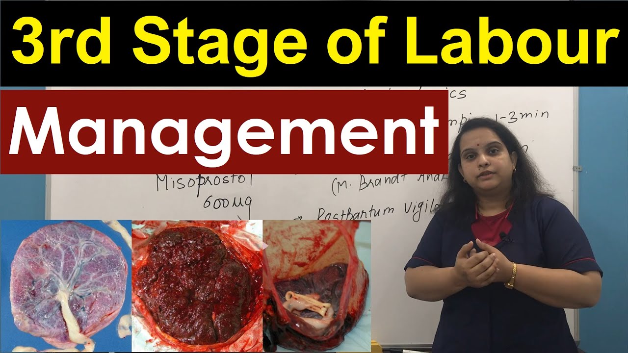 Management of Third Stage of Labour | Normal Labour | Nursing Lecture