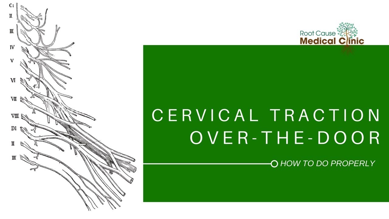 Over-the-Door Cervical Traction: How To