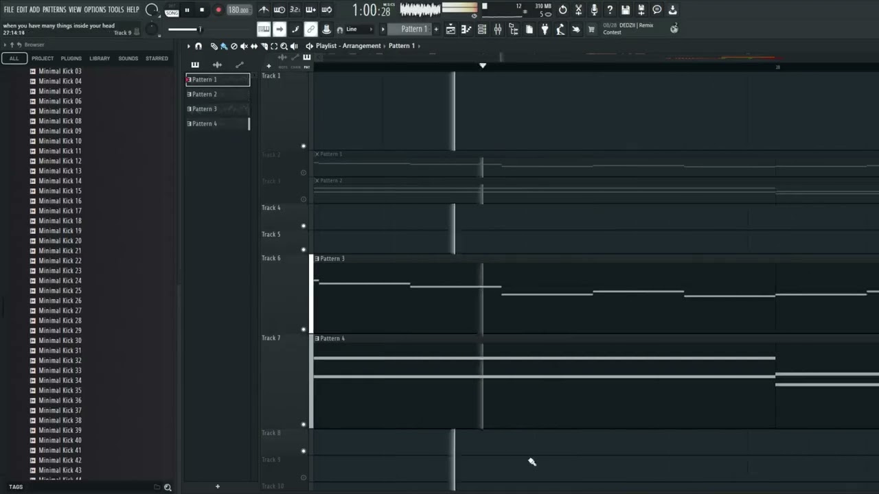 [Music] when you have many things inside your head