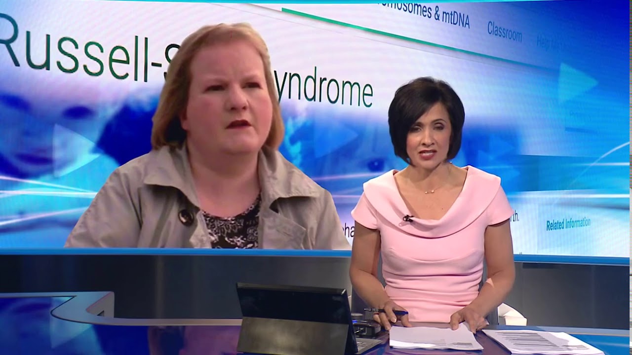 Ben Philip - STV News at Six - Russell Silver Syndrome