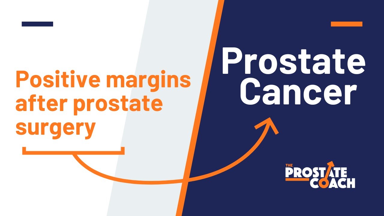 Positive margin after radical prostatectomy for prostate cancer
