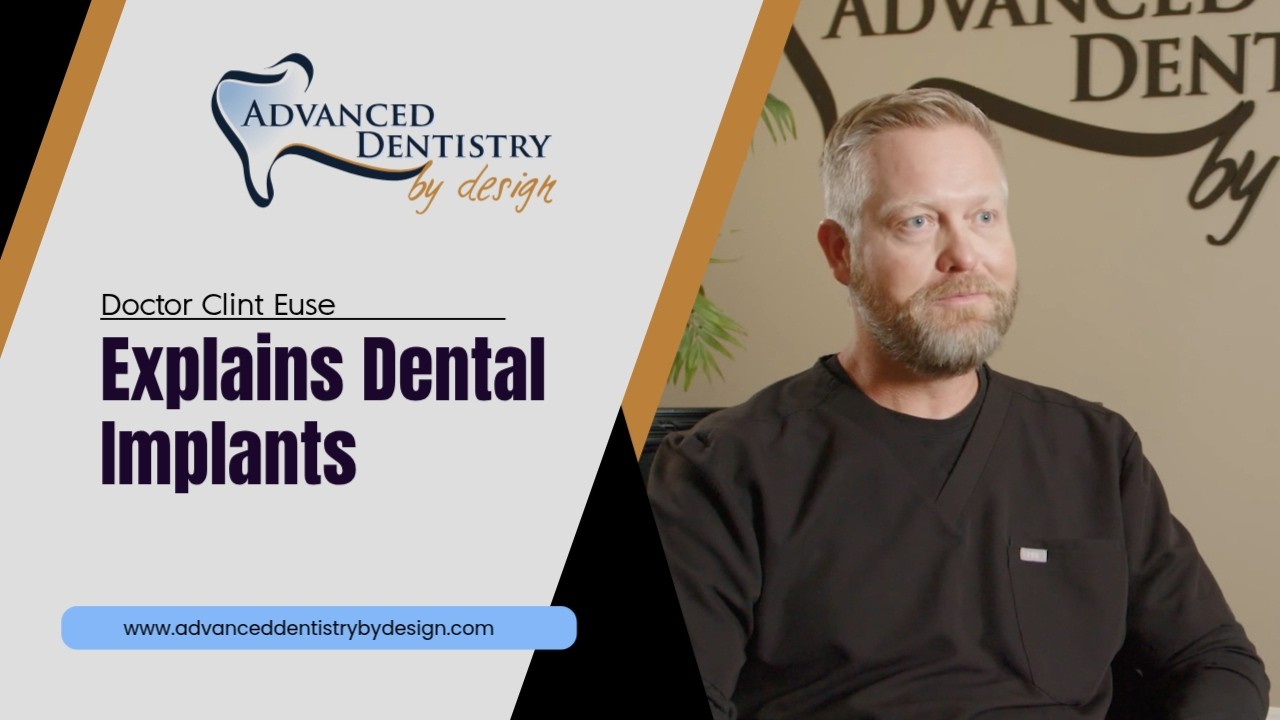 Dr. Clint Euse Explains Dental Implants