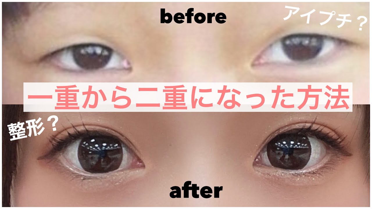 ももなが一重から二重になった方法を紹介します！