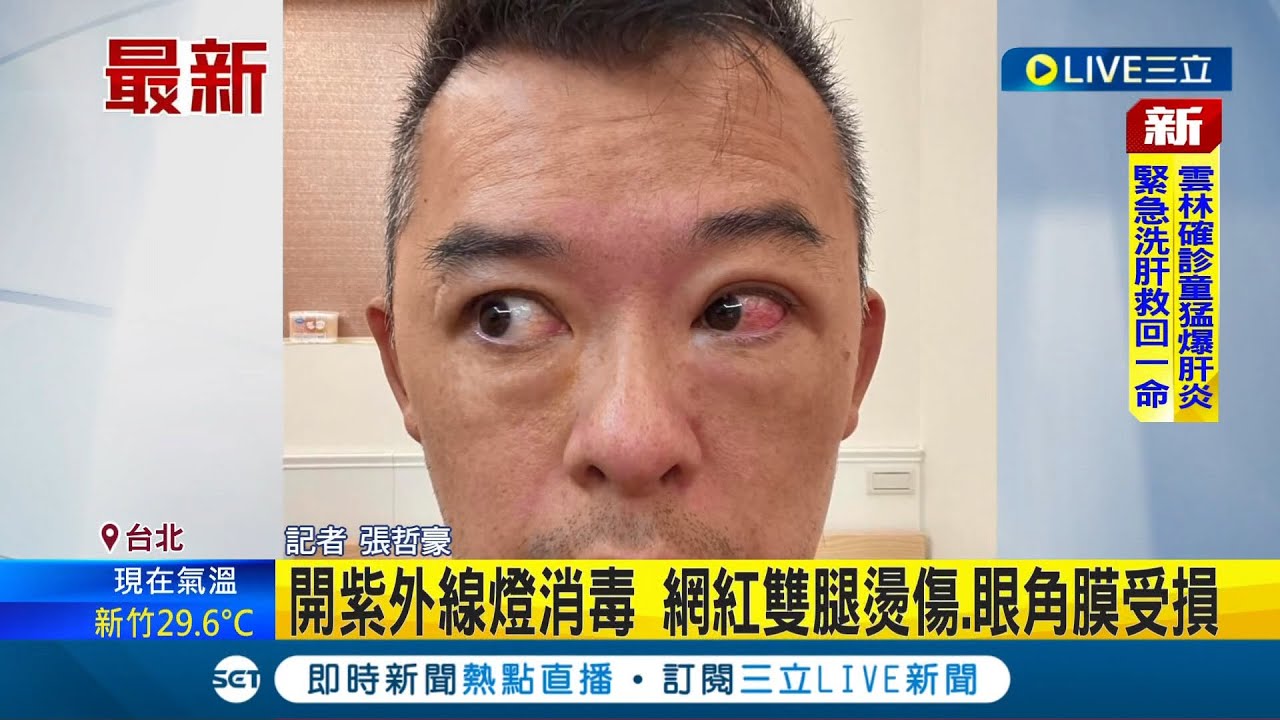 #三立最新  紫外線燈殺菌恐傷人! 開紫外線燈消毒 網紅雙腿燙傷.眼角膜受損 紫外線燈消毒要注意 醫師建議：人須離開該空間│記者 張哲豪│【LIVE大現場】20220613│三立新聞台