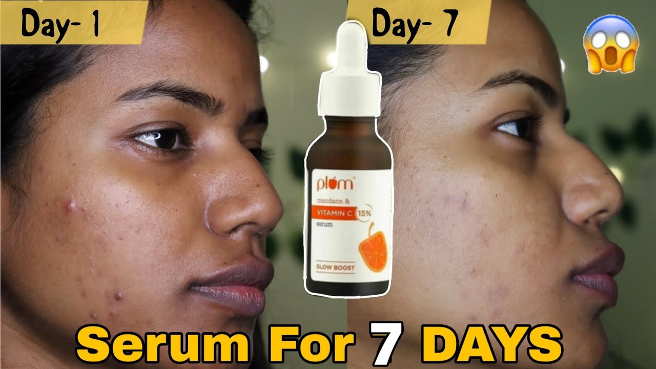 I Tried Vitamin C serum for 7 days | OMG This Happened |Ravina Gupta