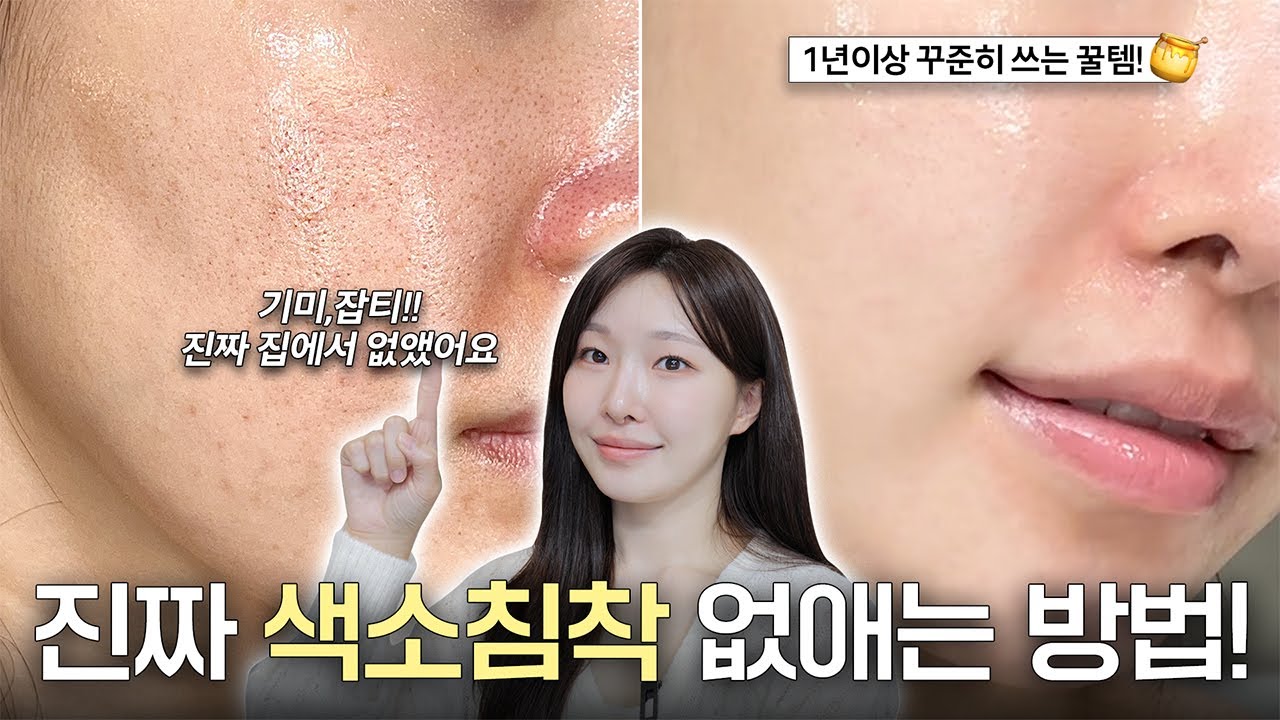 cc) No광고‼️효과보할게요..! 기미,색소침착에 효과봤던 스킨케어 알짜배기만 모았어요!🔥ㅣ아랑