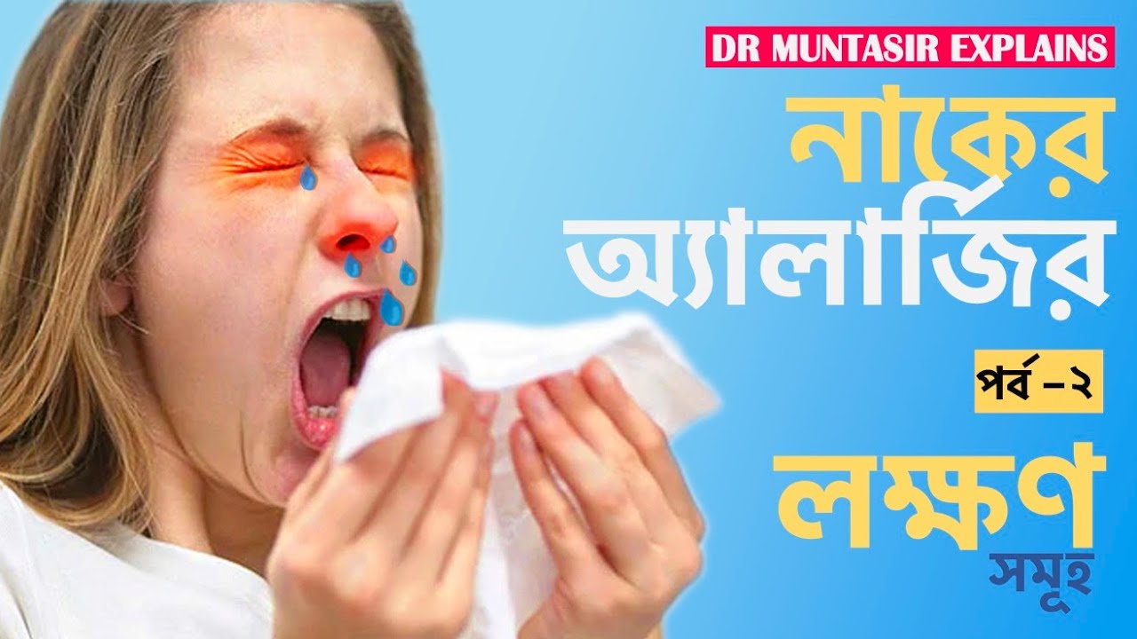 Nasal Allergy - Allergic Rhinitis - Sign & Symptoms - Bangla - ENT & Head Neck Surgery