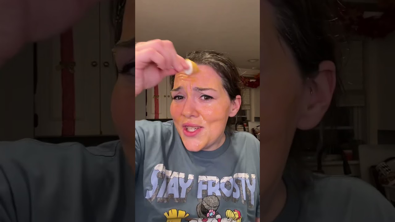 Seriously who has this kind of audacity? #frozenfacial #beautypops #loveandpebble #spillthetea #wwyd