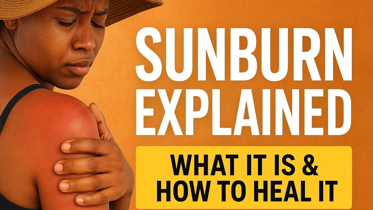 Sunburn Treatment & Prevention: Dermatologist-Style Guide for All Skin Tones