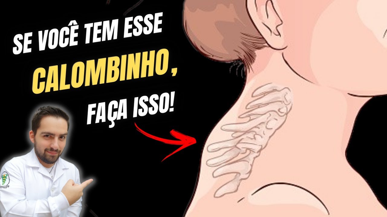 COMO ACABAR COM O CALOMBINHO NA NUCA COM APENAS 1 EXERCÍCIO