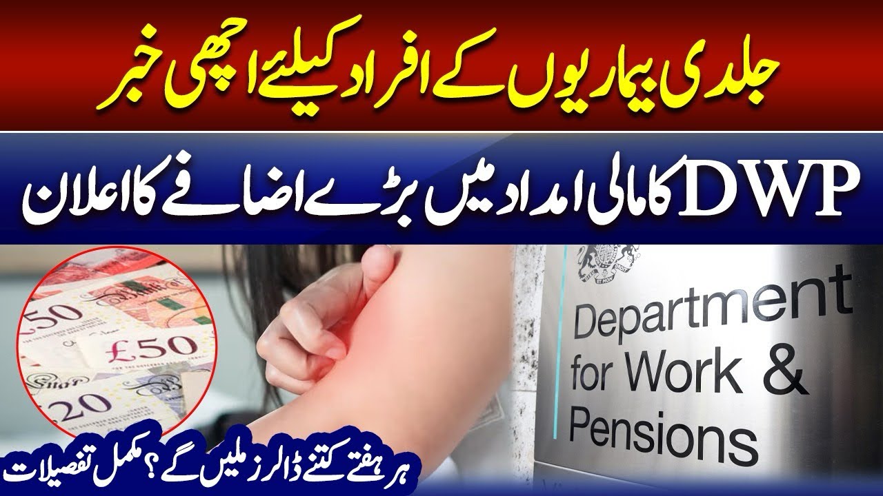 DWP Financial Support |These serious health conditions could qualify people for benefits | CNI News 