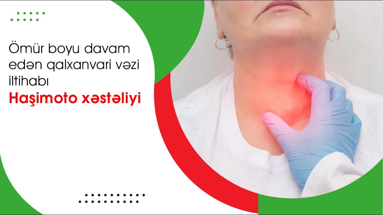 HAŞHİMOTO -AUTOİMMUN  TİREOİDİT XƏSTƏLİYİ NƏDİR❓