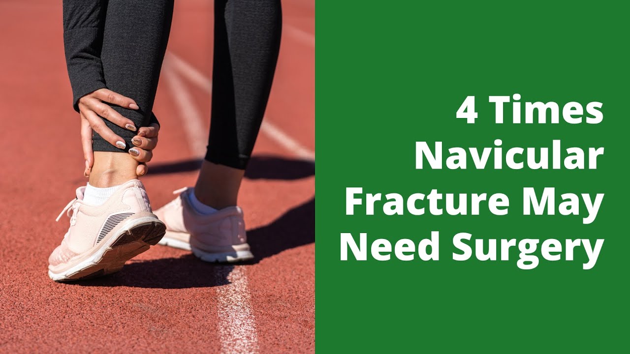 4 Times Navicular Fracture May Need Surgery