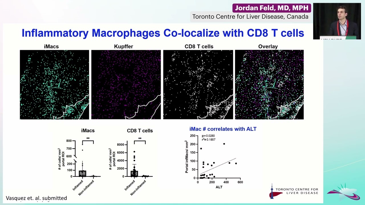Insights from Intrahepatic Analysis in Clinical Trials for Chronic Hepatitis B -Jordan Feld, MD, MPH