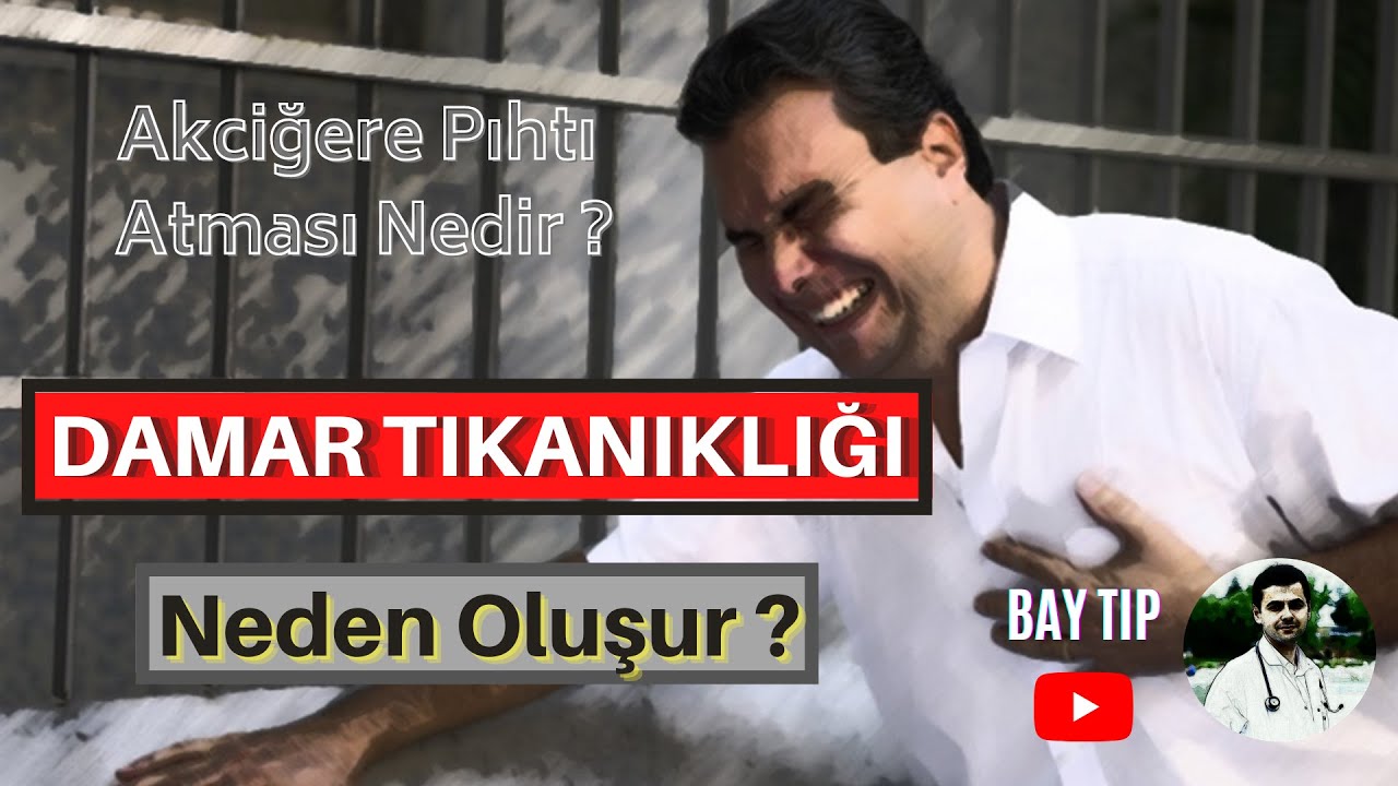 AKCİĞERE PIHTI ATMASI NEDİR? DAMAR TIKANIKLIĞI NEDEN OLUŞUR?