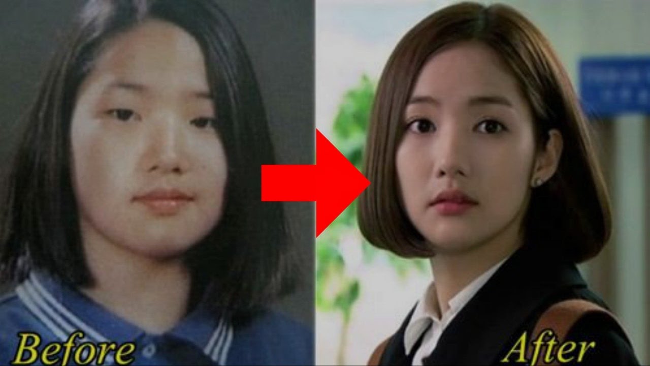 10 Korean celebrities who have admitted to plastic surgery
