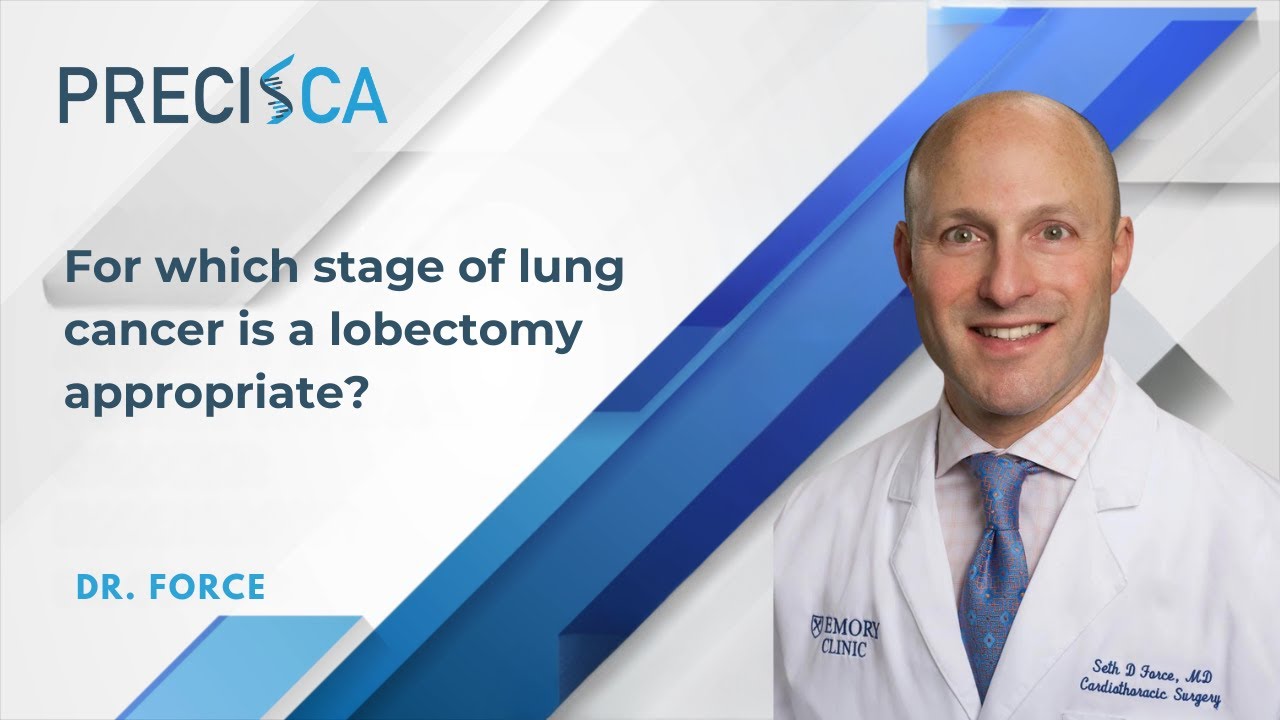 For which stages of lung cancer is a lobectomy appropriate?