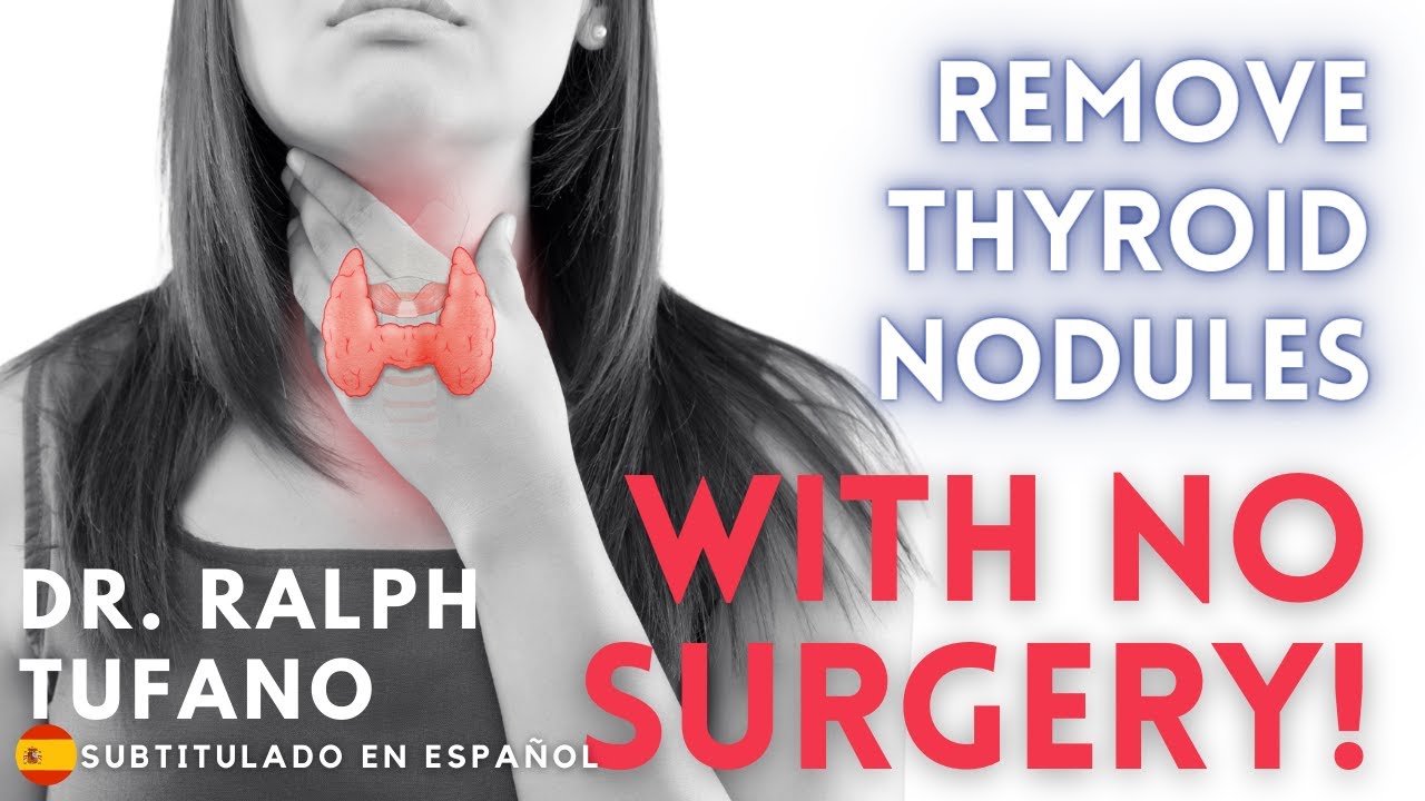 Radiofrequency Ablation 🛑 REMOVE Thyroid Nodules 🛑 NO SURGERY 🛑 Dr  Ralph Tufano