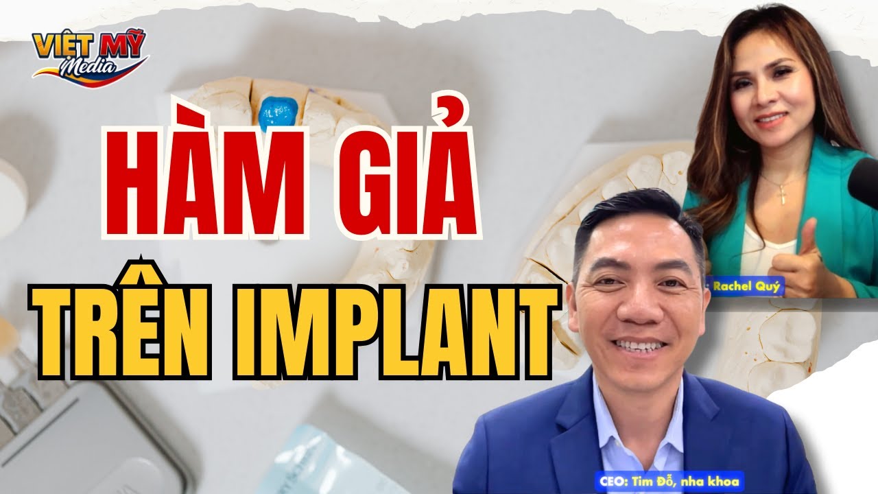 #627 - Hàm giả trên implant. 