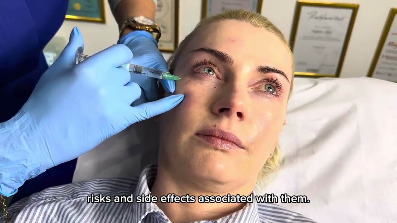 Wow! Lumi Eyes innovative procedure rejuvenating skin booster for dark circles and tired eyes