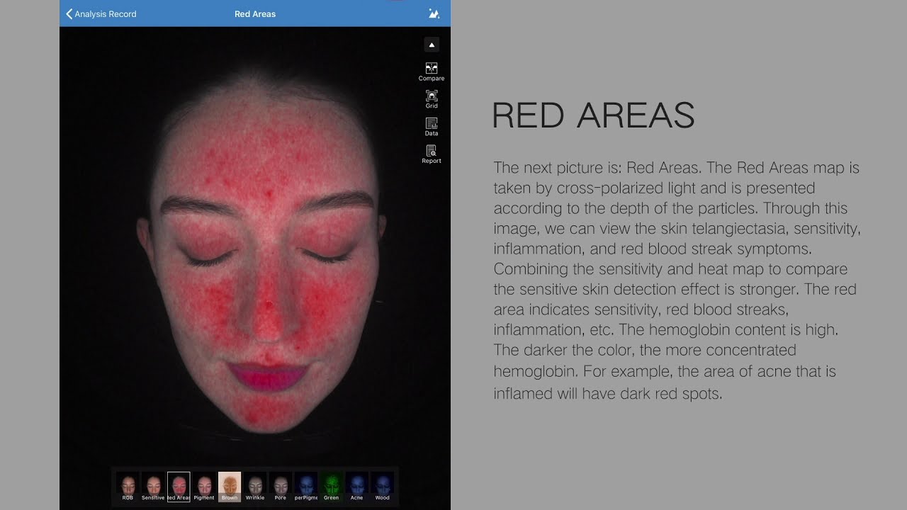 【MC88 Facial Skin Testing Education】