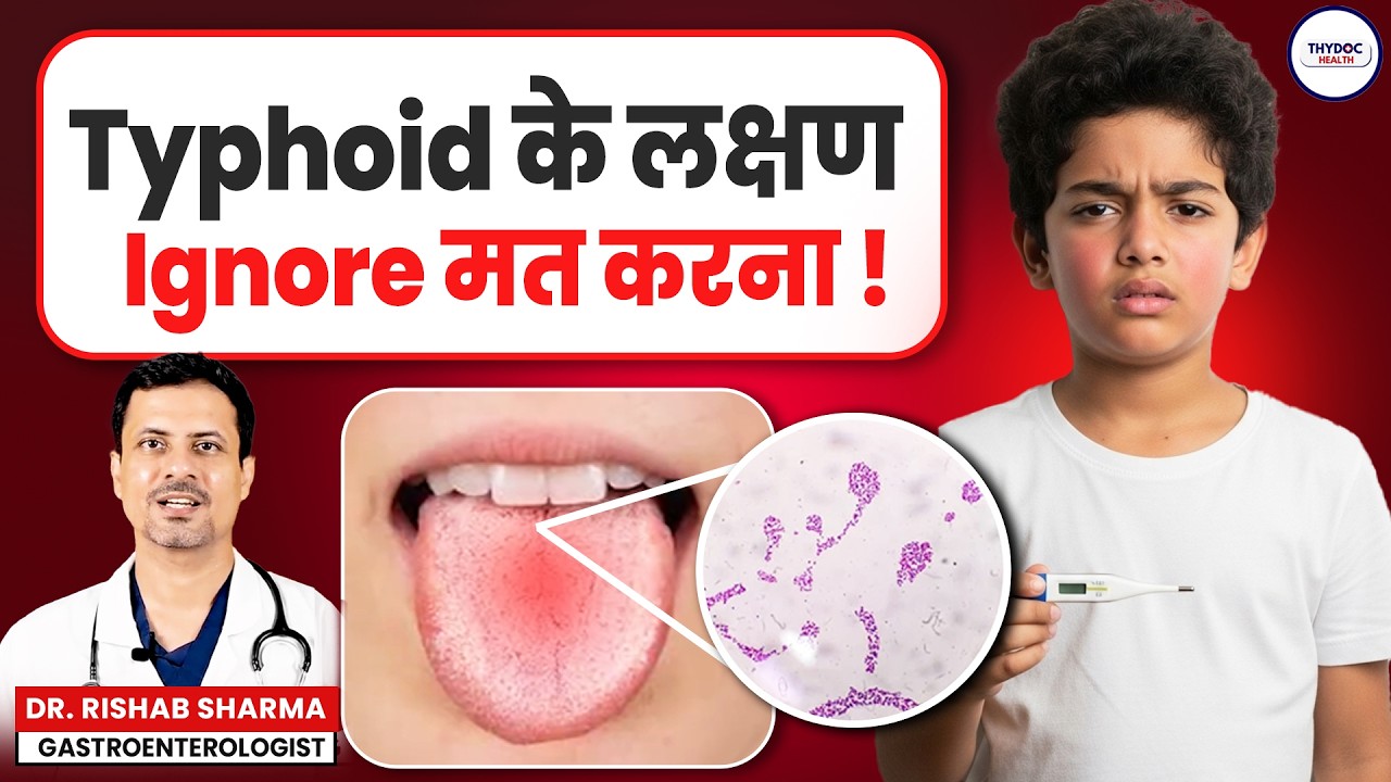 THYPHOID के लक्षण ⁉️ Bachon me Typhoid Kaise Pehchaane ⁉️ Typhoid Treatment | Typhoid Symptoms