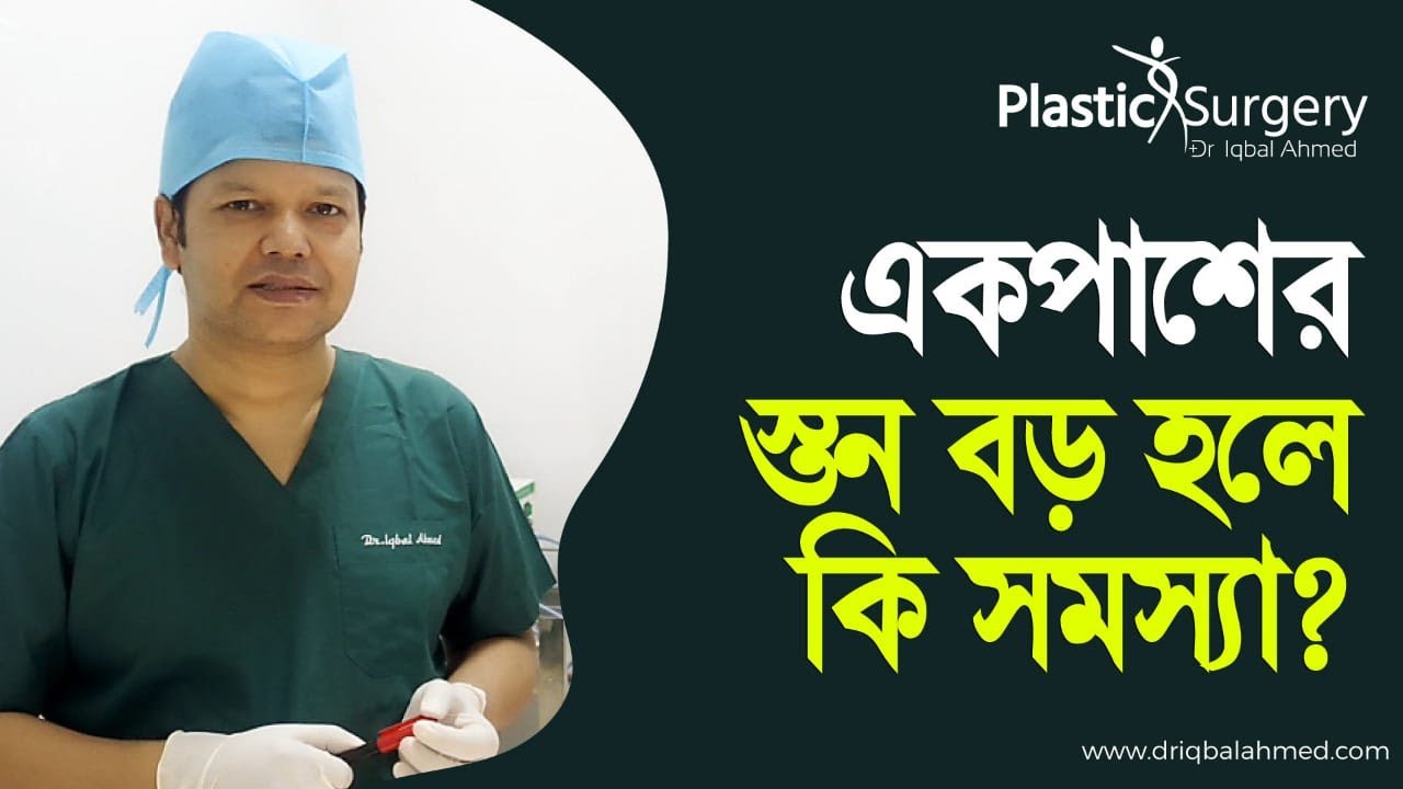একপাশের স্তন বড় হলে কি সমস্যা | Unilateral Gynecomastia Surgery Bangladesh