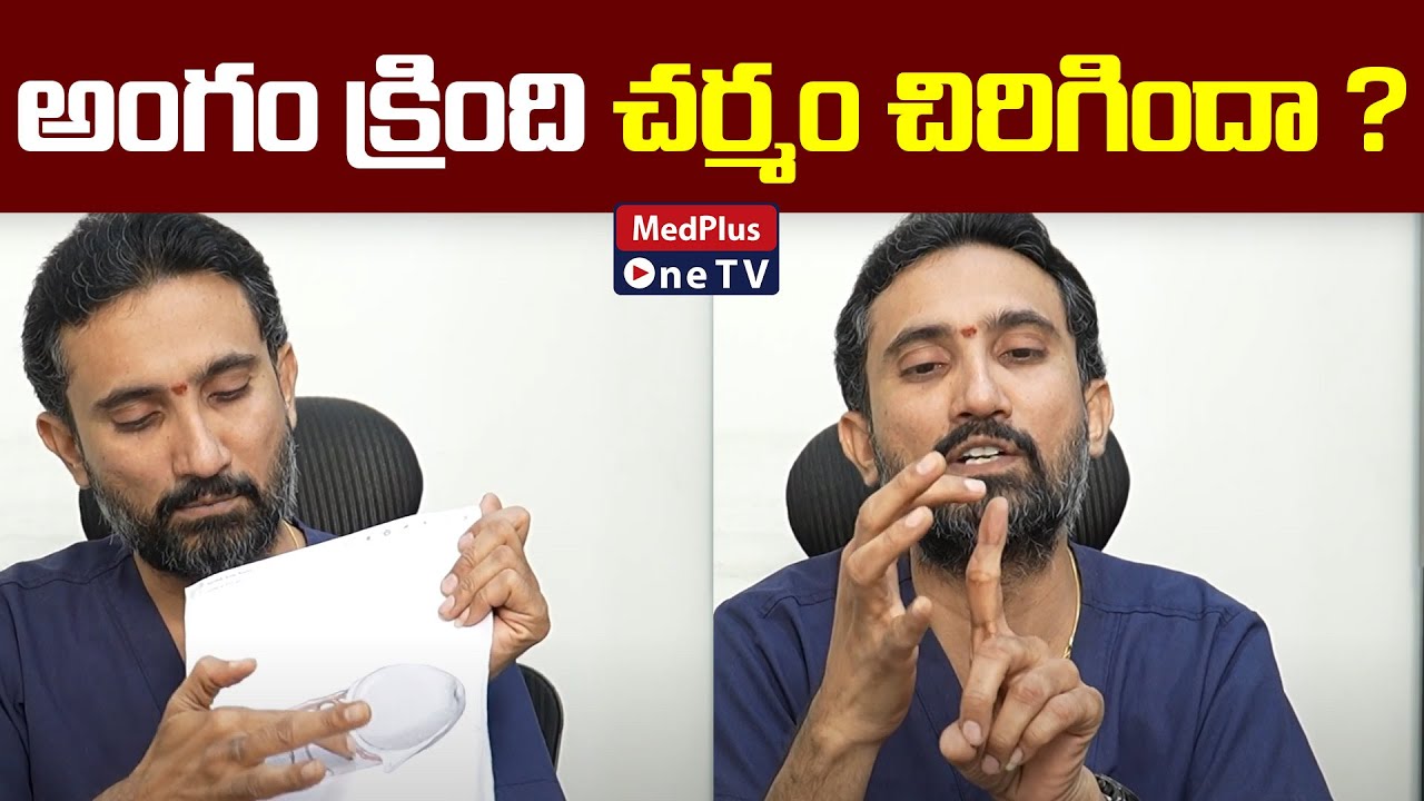 Penis Frenulum చిరిగిందా ? | Dr.Surendra Reddy @MedPlus ONE TV