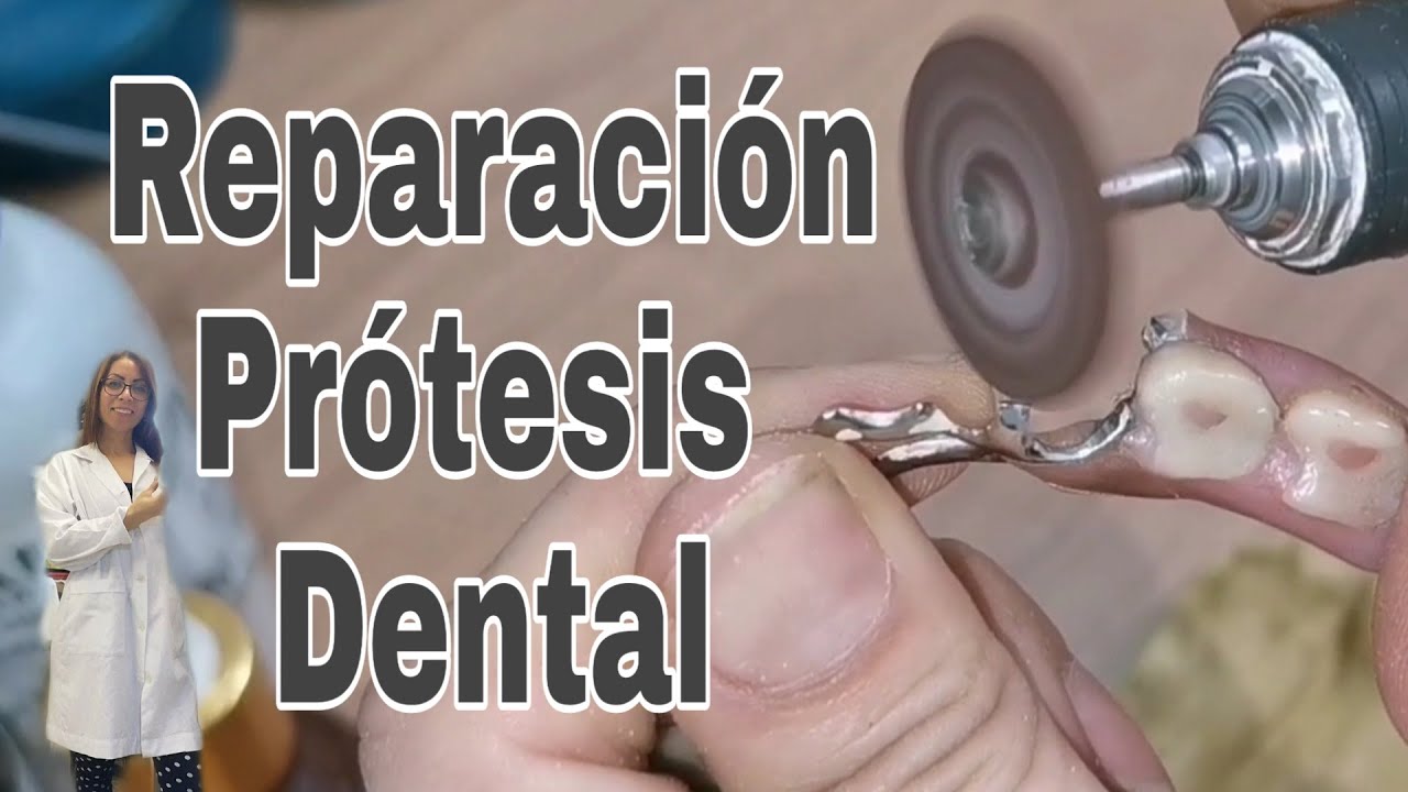 Cómo se repara una prótesis dental
