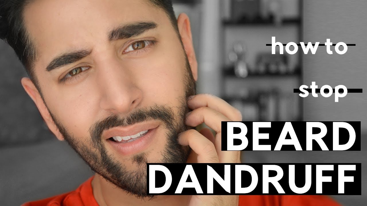 How To Stop Beard Dandruff / Itchy Beard And Flakey Skincare - ✖ James Welsh