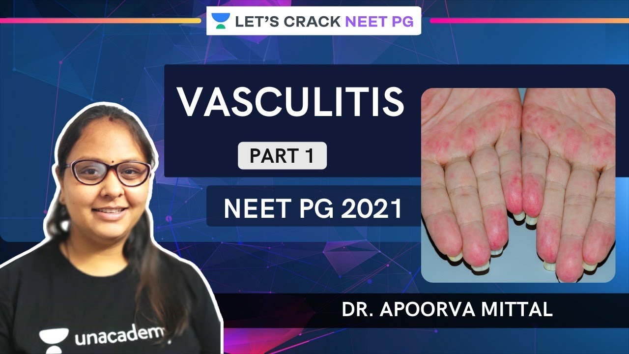Vasculitis -1 | NEET PG 2021 | Dr. Apoorva Mittal