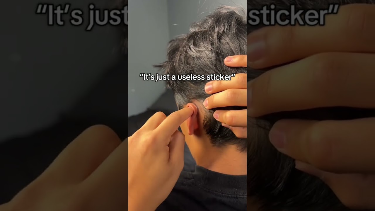 POV: You finally find solution for your protruding ears 🥹 
