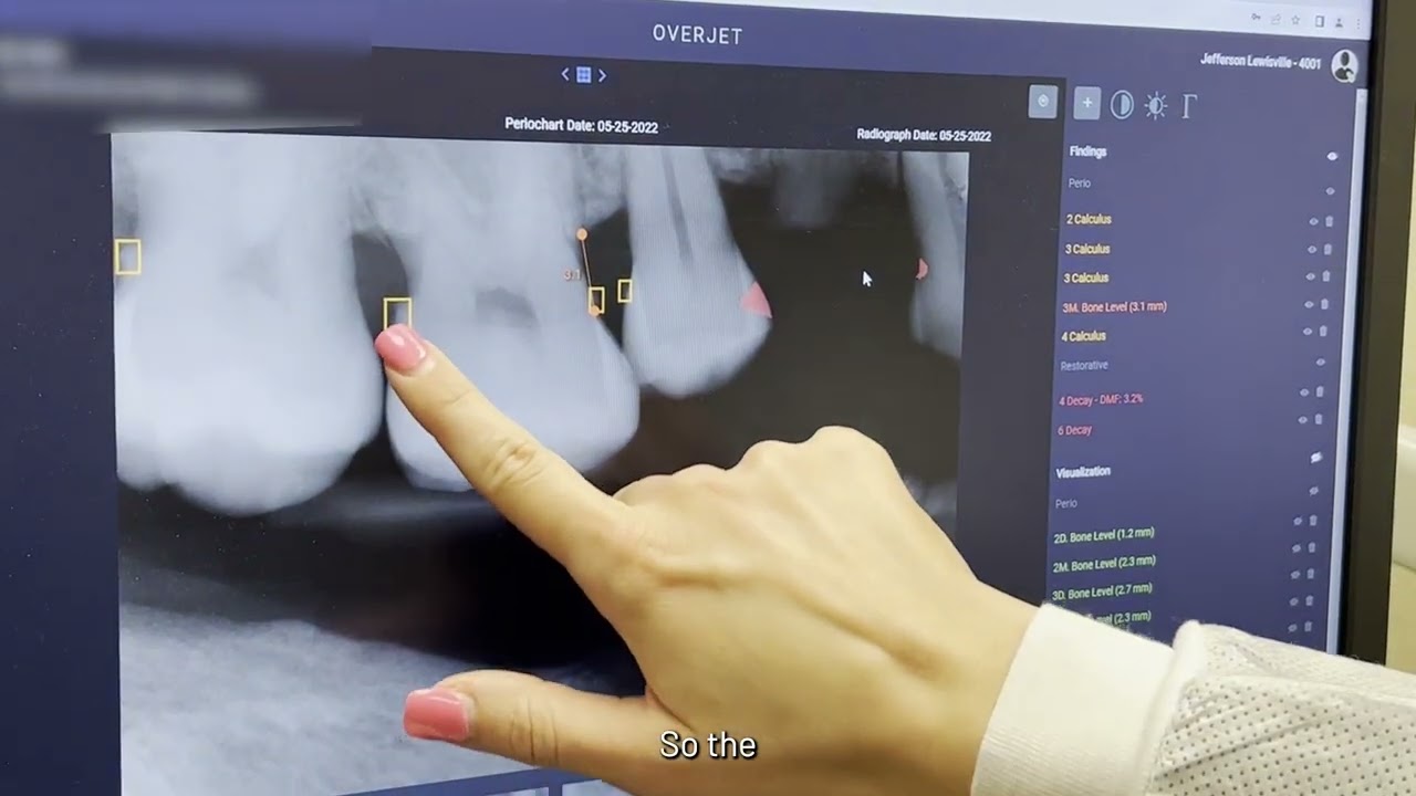 Using Overjet (AI) to Improve Our Patient Experience