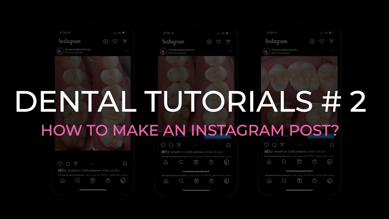 DENTAL TUTORIALS #2 - HOW TO MAKE AN INSTAGRAM POST?