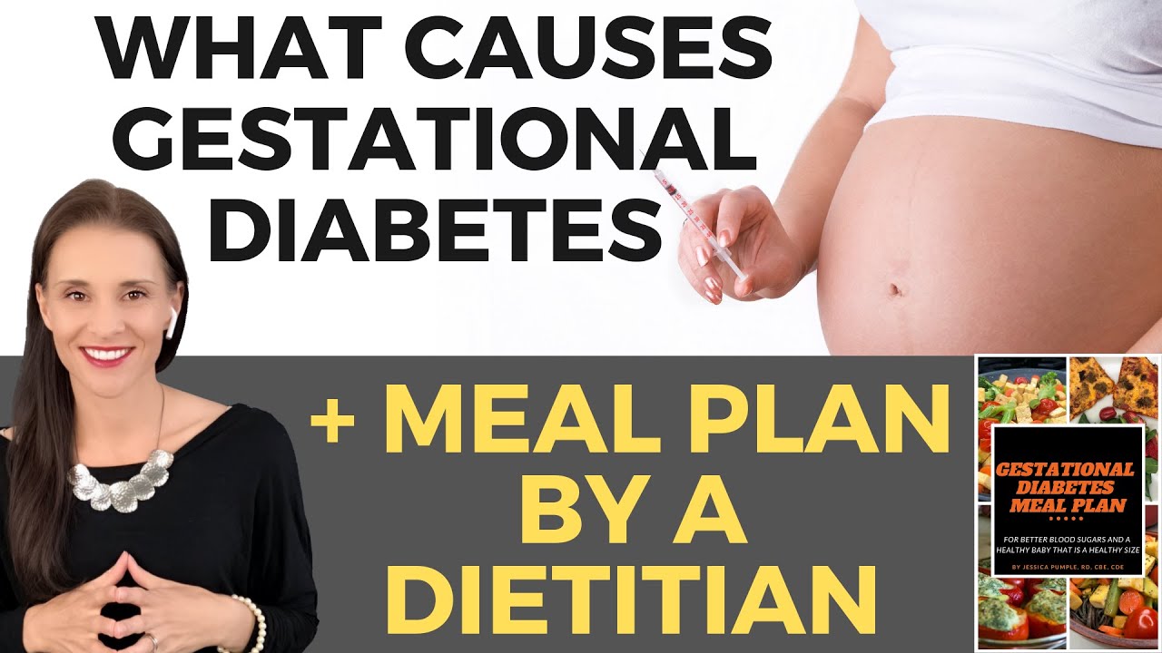 What causes gestational diabetes? 3 things you need to know.