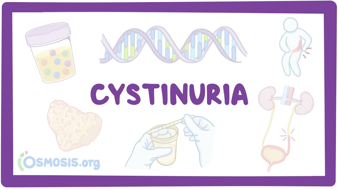 Cystinuria (NORD)