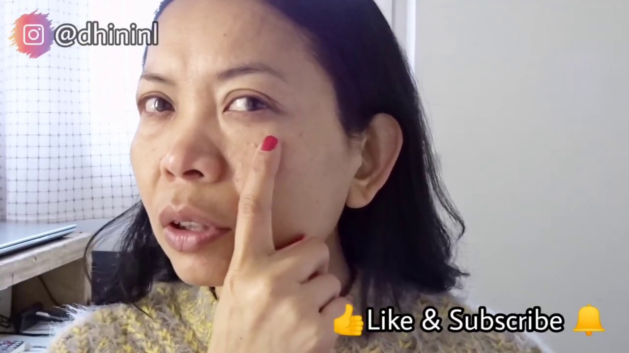 REMESCAR voor wallen & Donker kringen. Helpt het wel of niet?