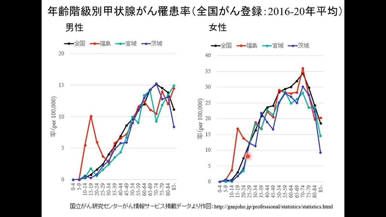 国際医療福祉大学 津金昌一郎  甲状腺がんと診断されること、甲状腺がんで命を落とすこと