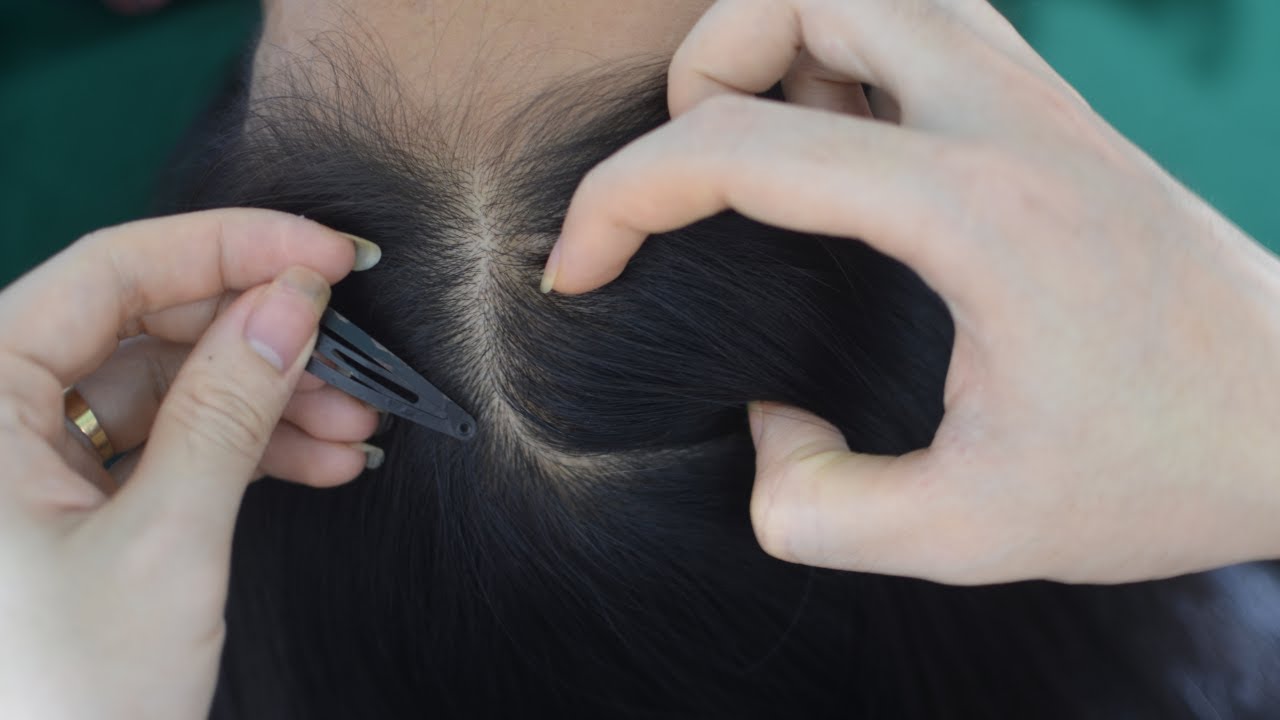 ASMR No Talking Scalp Scratching, Scalp Massage, Hair Combing On Real Person For Stress Relief