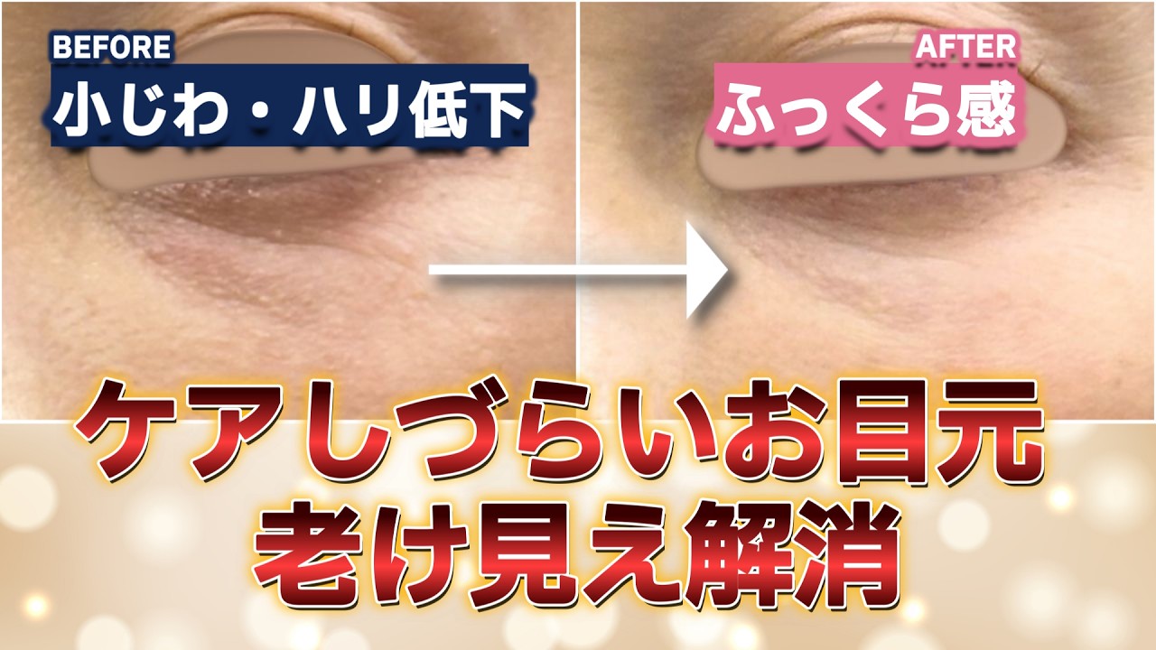 アイクリームで治らない「目の下のシワ」に。ジャルプロヤングアイ×デンシティーで目元が劇的に若返る理由