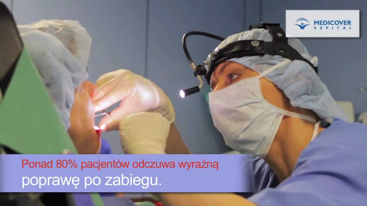 Operacja Medicover