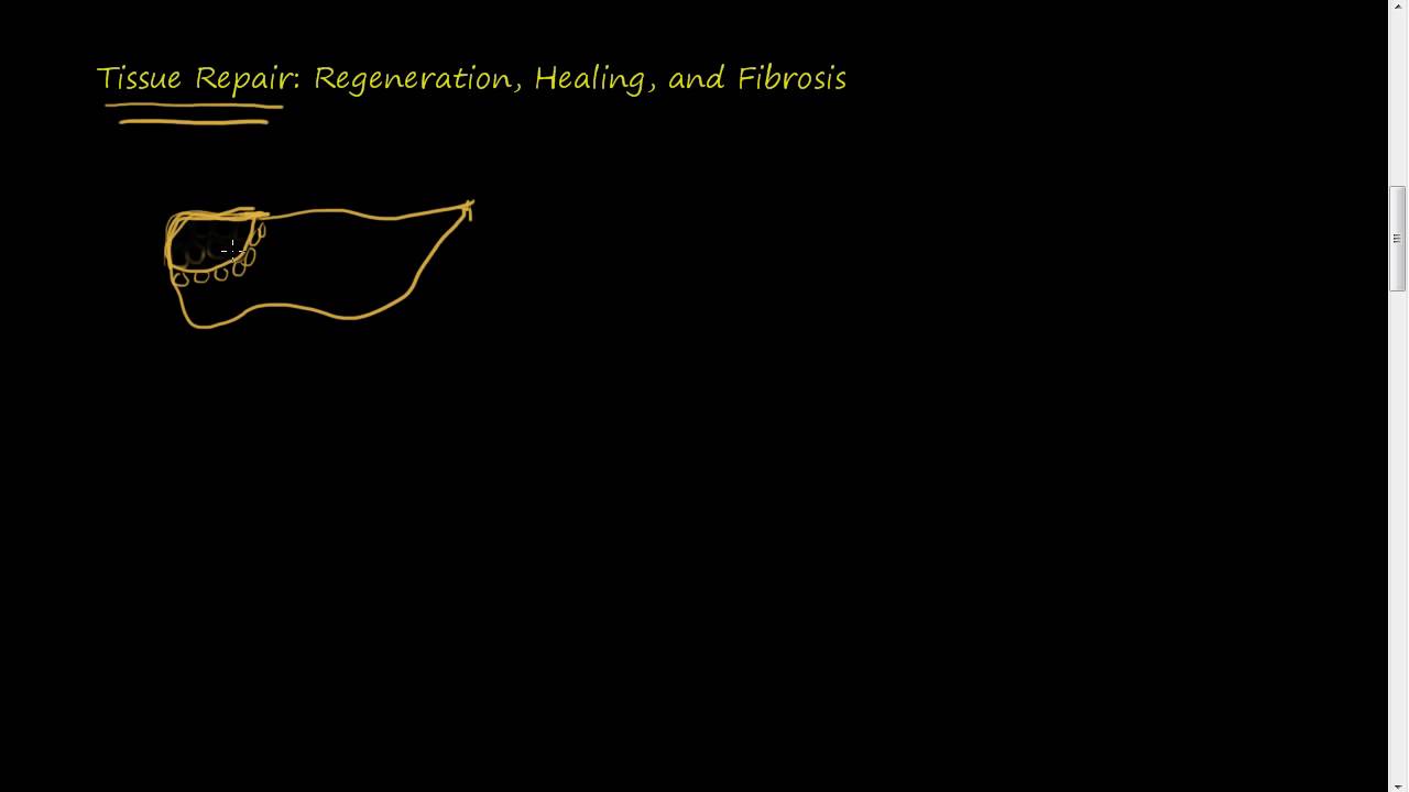 #31 -Tissue Repair- Regeneration, Healing, Fibrosis