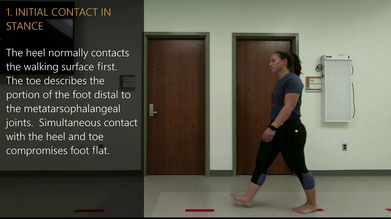 Edinburgh Visual Gait Score